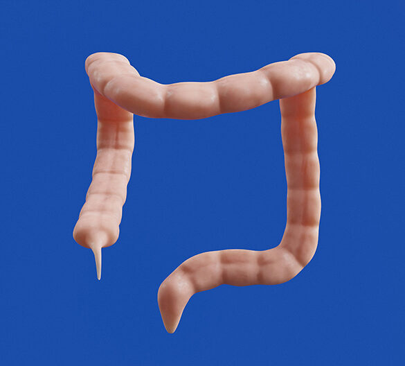 Colon ilustración